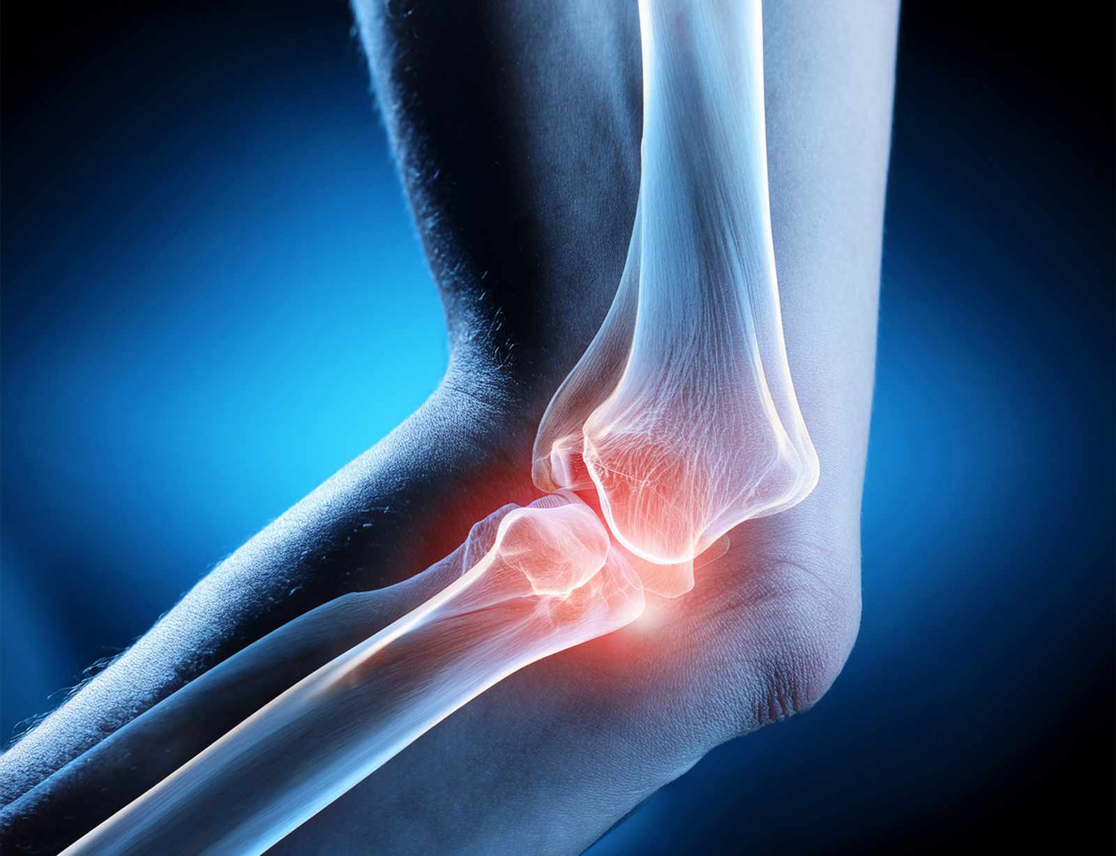 Ellenbogenschmerzen Orthopädie Köln